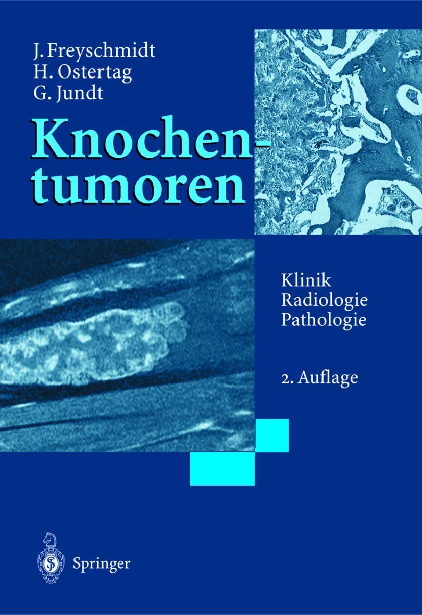 Knochentumoren Klinik, Radiologie, Pathologie